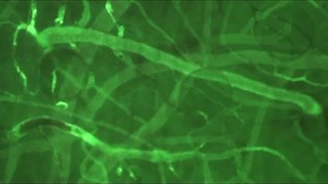 File:Graphene-based-carbon-layered-electrode-array-technology-for-neural-imaging-and-optogenetic-ncomms6258-s2.ogv - Wikimedia Commons