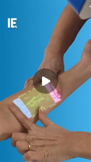 Interesting Engineering on Instagram: "Vein scanning technology is a relatively new innovation in medicine. It non-invasively shows a patient's veins and bloodflow. That allows doctors to spot any problems in advance, and speed up treatment."
