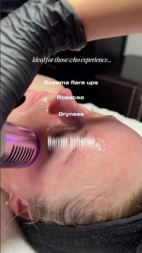 Cooling Facial Therapy You Need to See