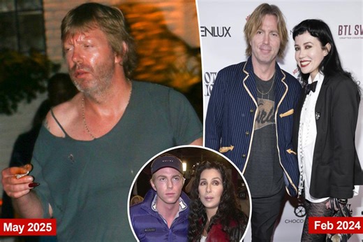 Cher’s son Elijah Blue Allman disheveled with fake nail, sores at LA hotspot after singer sounded alarm on his ‘mental health’