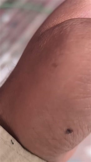 Door lock installation