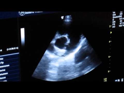 Echocardiogram of PDA in a Dog