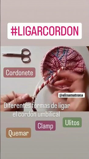 formas de ligar el cordón umbilical