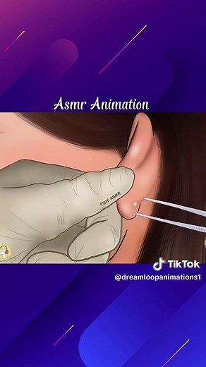 Ear Cleaning and Treatment ASMR Animation