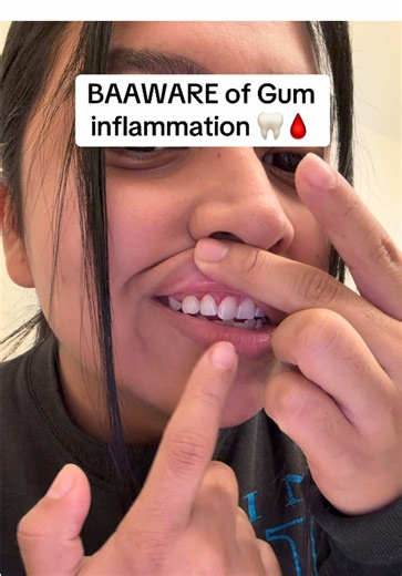Gum Inflammation Awareness: Total Smile Makeover Kit