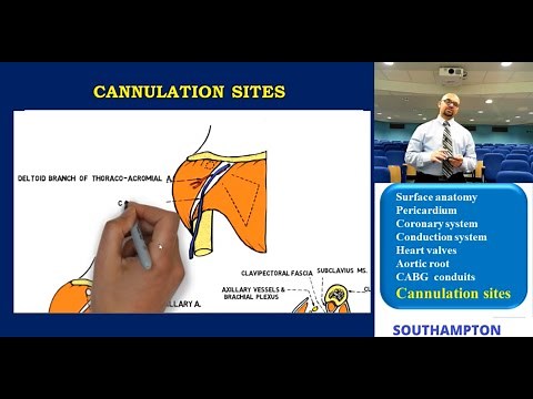Cardiac Anatomy: Cannulation Sites Anatomy