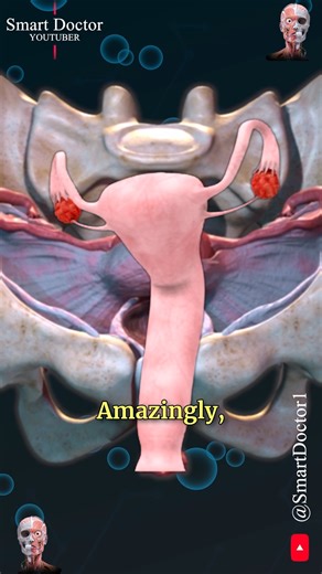 Smart Doctor on Instagram‎: "Uterus and Ovary | Captivating Pelvic Panorama ✨‍♀️ . . The anatomy of the female pelvis is complex and includes several key structures and openings. Here’s an overview: Key Structures Pelvic Bones: Ilium: The largest part of the pelvis. Ischium: The lower, posterior part of the pelvis. Pubis: The anterior part of the pelvis. Sacrum: A triangular bone at the base of the spine, forming the back of the pelvis. Coccyx: The tailbone, located at the very base of the sacru