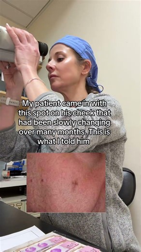 Can you guess what this brown spot turned out to be? See description and pinned comment #melanoma