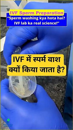 Day 32 – IVF Sperm Preparation | IVF Lab Secrets #ivf #drrakshitamalik #ivfjourney #ivfawareness