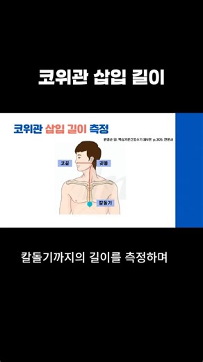 How to Measure Nasogastric Tube Insertion Length - Master the Method Before the Exam! #NursingStu...