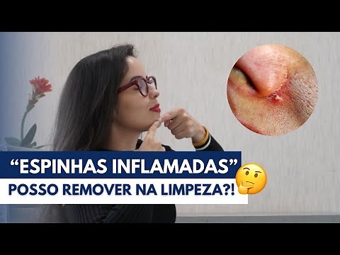 "ESPINHA INFLAMADA" | Posso remover pústulas e pápulas durante a Limpeza de pele ?!