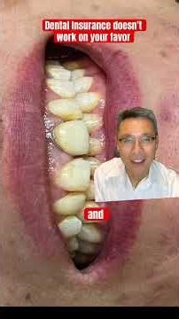 Dental Insurance vs Cosmetic Dentistry #life #dentist #dentistry