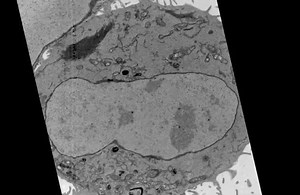 File:Acute-Manipulation-of-Diacylglycerol-Reveals-Roles-in-Nuclear-Envelope-Assembly-&-Endoplasmic-pone.0051150.s013.ogv - Wikimedia Commons