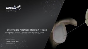 Tensionable Knotless Bankart Repair Using the Knotless 1.8 FiberTak® Implant System
