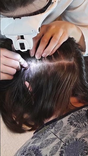 ASMR School Nurse LICE Check on Scalp and Neck | Lice Removal with a Comb #asmr #shorts #short