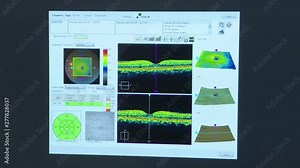 Ophthalmological examination on a computer , eye health check and visual acuity. Diagnosis of vision.3 d model of the retina.