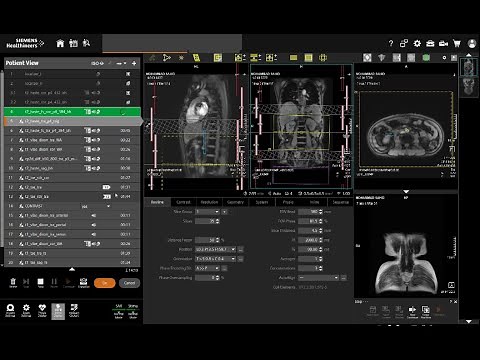 MRI Whole abdomen with contrast