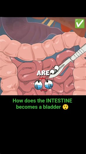 how does the INTESTINE becomes a bladder 😲 #animation #anime #cartoon #bladder #sus #health