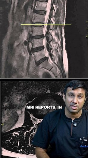 Slip disc: When is surgery necessary?