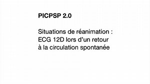 Démo technique -ECG post-ROSC