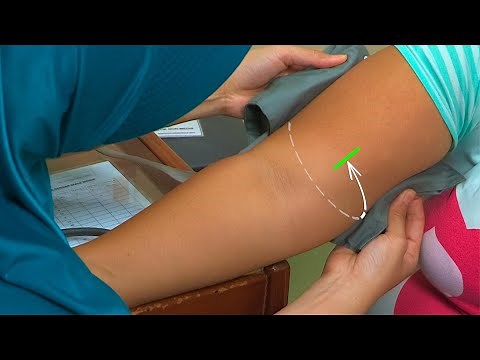 Blood Pressure Measurement for the Large Arm - Diabetes Series