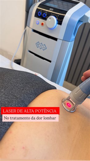 Dr Luiz Severo NEUROCIRURGIA DOR | Dor crônica on Instagram: "Como o Laser de Alta Potência melhora a dor lombar? A dor lombar é uma das queixas mais comuns no consultório — e, muitas vezes, está ligada a inflamação, tensão muscular e alterações dos tecidos profundos. O Laser de Alta Potência (HILT) é uma das tecnologias mais modernas para tratar essas causas de forma rápida, segura e eficaz. ✔️ Como ele funciona? O laser penetra profundamente no tecido e promove três efeitos principais: 1️⃣ Ant