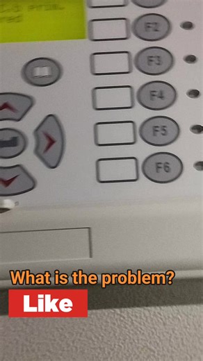 What is the problem Micom p632 ? #protection #electrical #transformers | Power systems protection