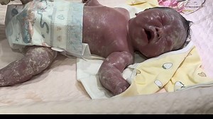 After the newborn is born, there are many white stains on his bodies, and soon help him clean up | Viral Video