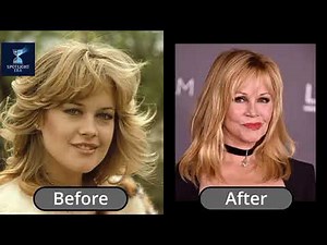 45+ Celebrity Plastic Surgery Disasters Shocking Before and After Transformations 😱👩‍⚕️