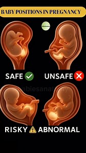 How Babies Can Rest in Different Positions During Pregnancy During pregnancy, babies naturally move and adjust their position inside the womb. Some positions are more common at certain stages, while others may change as space, growth, and movement evolve. This visual helps illustrate how different positions can look inside the uterus, offering general awareness through artistic representation. Every pregnancy is different, and positions can vary from one mother to another. This content is shared