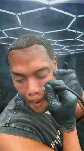 Vacuuming My Face. Removing Excess Oil Buildup From Deep Within My Pores Gave My Skin Instant Relief. My Skin Immediately Felt Like It Could Breathe 🧘🏽‍♂️. #LosAngeles #losangelesesthetician #atlanta #skincare #Revamped