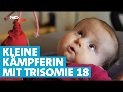 Medizinisch ein kleines Wunder: Mia hat Trisomie 18 und ist jetzt 10 Monate alt