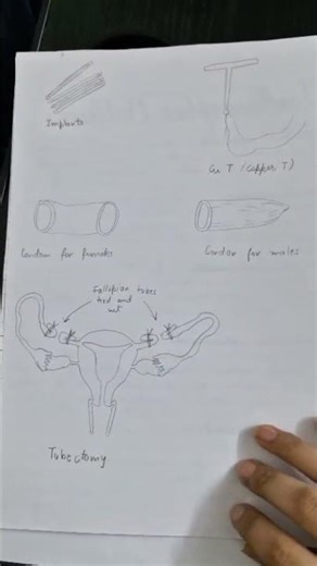 easy Investigatory project...topic:Reproductive health..also creadits to anshi.shxrma#12th #cbse