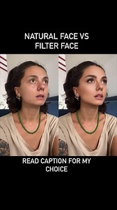 Kali Fontanilla on Instagram: "I’ll take a natural face any day. So many women are rushing to get plastic surgery just to look like a filtered version of themselves. But there’s nothing more beautiful than unique, distinct features, the way God made you! It’s far more striking than these plastic, cookie cutter Instagram faces where everyone starts to look the same. When women go too far down that plastic Barbie doll route, they start to look trans. I’m not exaggerating. If you look at a trans pe