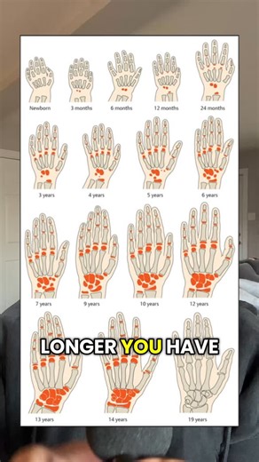 Nicholas Fraser on Instagram: "Here’s how to tell if your growth plates are open or closed . . . #heightgrowth #transformation #glowup #looksmaxx"