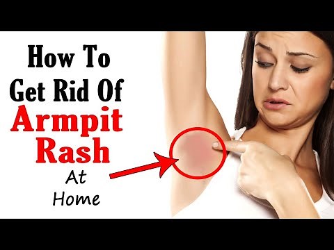 Say Goodbye to Armpit Rash Naturally – Fast & Easy Remedies!