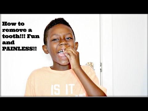 How to remove a tooth!!! FUN AND PAINLESS!!