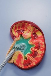 1.9M views · 9.7K reactions | Medical Procedures Explained in a Fascinating Way | Health is Wealth | Facebook