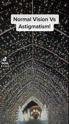 Understanding the Differences: Normal Vision Vs Astigmatism