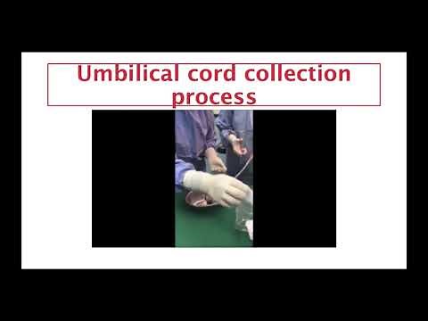 Umbilical cord collection for stem cell culture