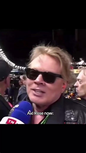 Axl Rose Then and Now: A Transformation Journey