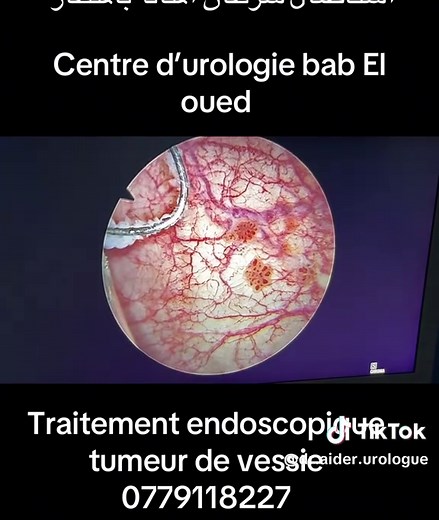 #urologue #algerie #medecine #alger #شعب_الصيني_ماله_حل😂😂
