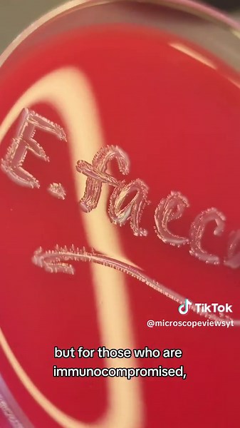 Imagine this baddie swimming in your peehole 😍 Enterococcus faecalis ‼️⚠️🤓 📚🧪🧫🦠🔬 #healthcare #health #medicina #medicine #medtech #medtechstudent #medschool #medicalschool #medicaltiktok #medicalhumor #medicaltechnologist #doctor #wellness #healthcareworker #microbiology #scienceexperiments #laboratory #laboratorio #urine #urinalysis #urinarytractinfection #immunology #biology #chemistry #hematology #biochemistry #bacterialvaginosis #bacterialvaginosistalks #yeast #yeastinfection #stdawar