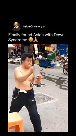 A1 Media Dose on Instagram: "Down syndrome isn’t defined by race - it occurs across all ethnicities worldwide at similar rates. It’s caused by an extra copy of chromosome 21, which affects development, learning style, and physical traits, but not a person’s potential. People with Down syndrome often show strong social intelligence, empathy, and visual learning skills. With access to education, healthcare, and supportive environments, many live independently, work jobs, create art, play sports, a