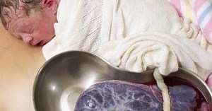 The incredible photo of delayed cord clamping after birth - Netmums