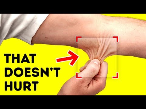 Pinch Your Elbow and See What Happens + 100 Crazy Body Facts