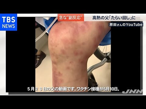 ワクチン接種、急な“副反応”に「たらい回し」も