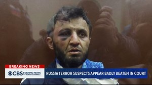 Russia terror suspects appear beaten in court