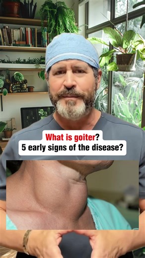 What is goiter? 5 early signs of the disease? #goiter #thyroid #healthtip #usa