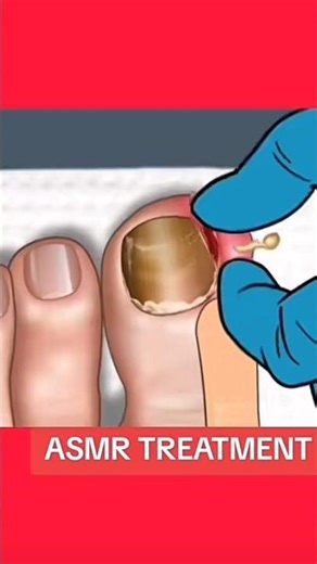 ASMR Insane Toe#tiktok #animation #foryou #satisfying #shortvideo #shortvideo #asmr #youtubeshorts